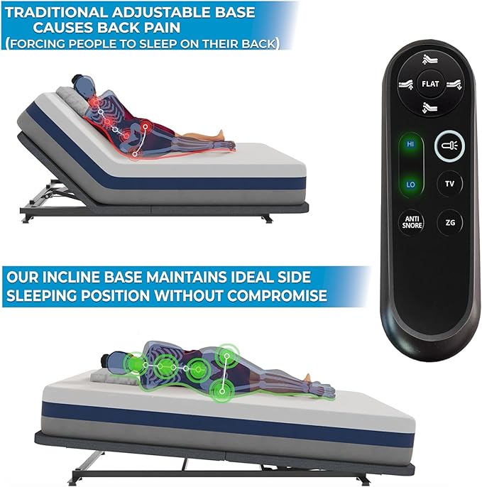 Boyd Sleep Full Body Incline Adjustable Bed Frame, Power Adjustable Base for Side Sleepers, Zero Gravity, Anti-Snore, King